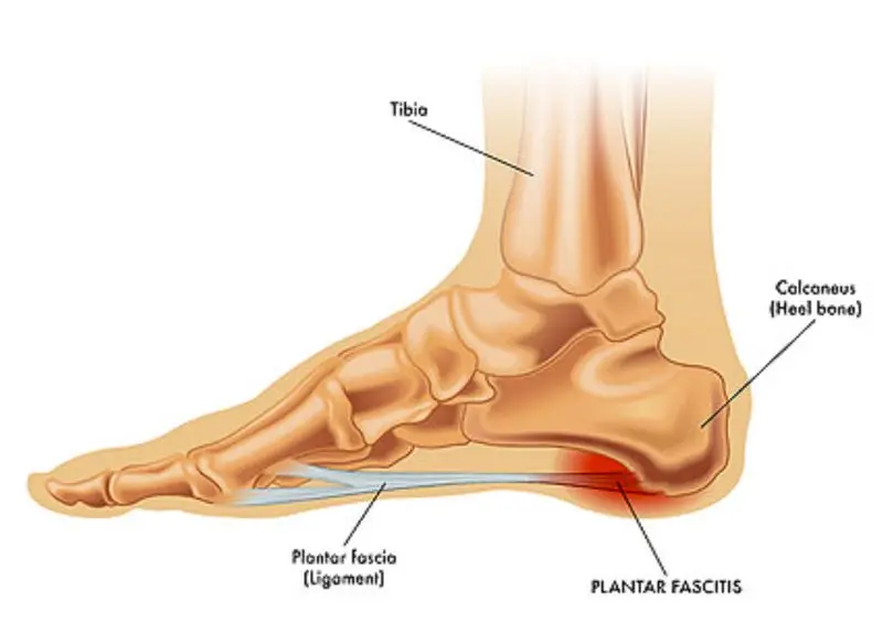 Foot structure affects how weight is distributed during steps
